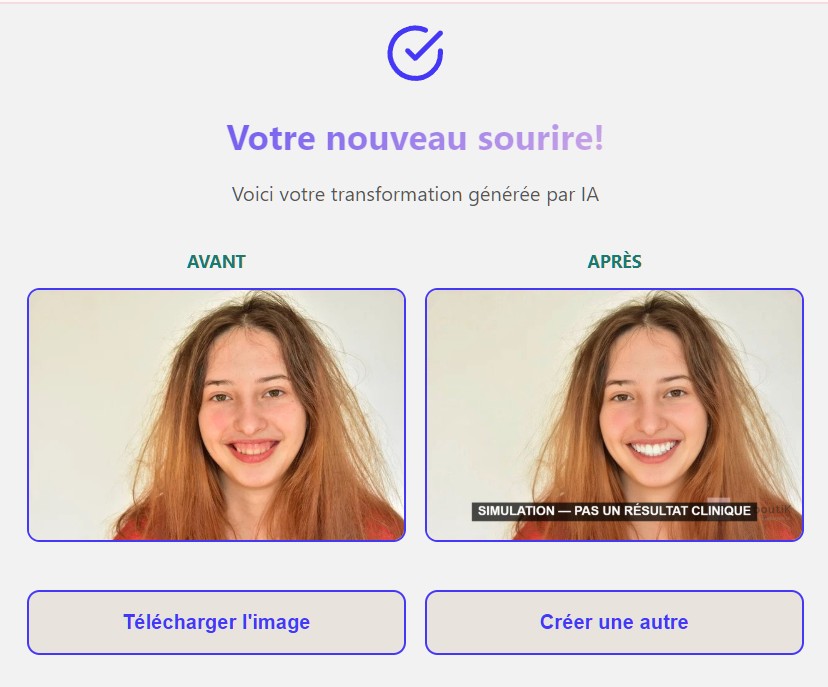 Simulation de sourire avant-après — Centre dentaire Smile boutiK Laval